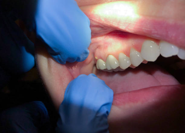 Best Emergency Denture Repair in Walford, IA